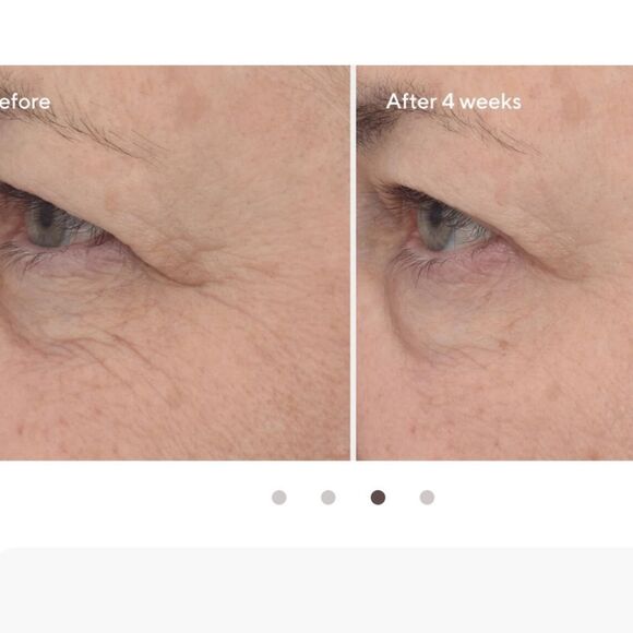 MURAD Retinal ReSculpt Eye Lift Treatment 15ml NEW IN BOX MSRP $92 - Picture 10 of 16